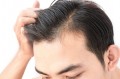 Caduta capelli: quali sono i rimedi?